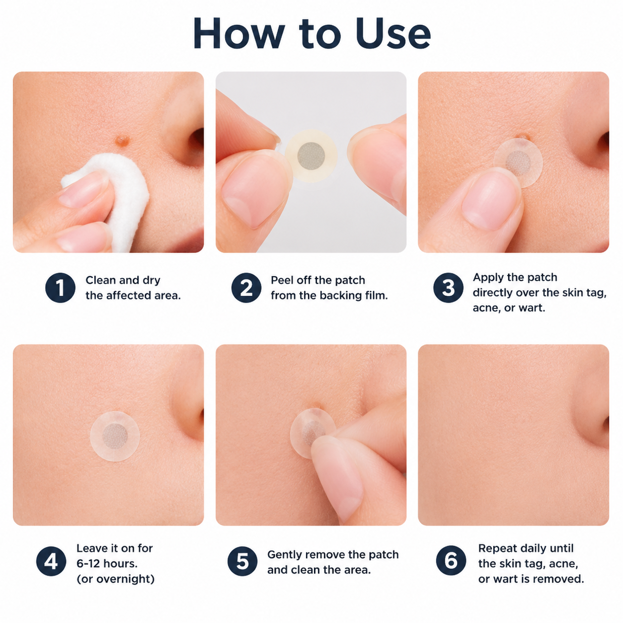 🔥Muwix®2-in-1 Microneedle & Hydrocolloid Patch🍀| Removes Raised Moles, Acne, Flat Warts & Skin Tags | Helps Improve Wrinkles, Scars & Blemishes | Invisible Patches for Face & Body