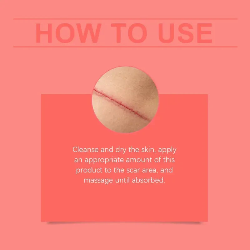 Advanced Silicone Scar Cream - Skin Repair Treatment for Surgical Acne Scars🩹