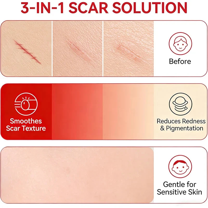 Advanced Silicone Scar Cream - Skin Repair Treatment for Surgical Acne Scars🩹