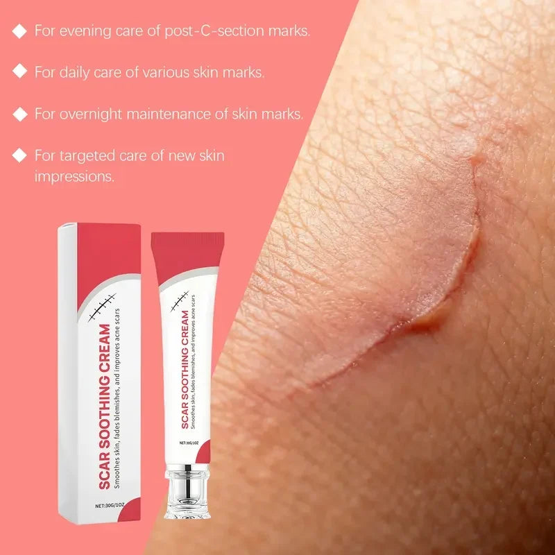 Advanced Silicone Scar Cream - Skin Repair Treatment for Surgical Acne Scars🩹
